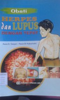 Obati Herpes dan Lupus Dengan Tepat